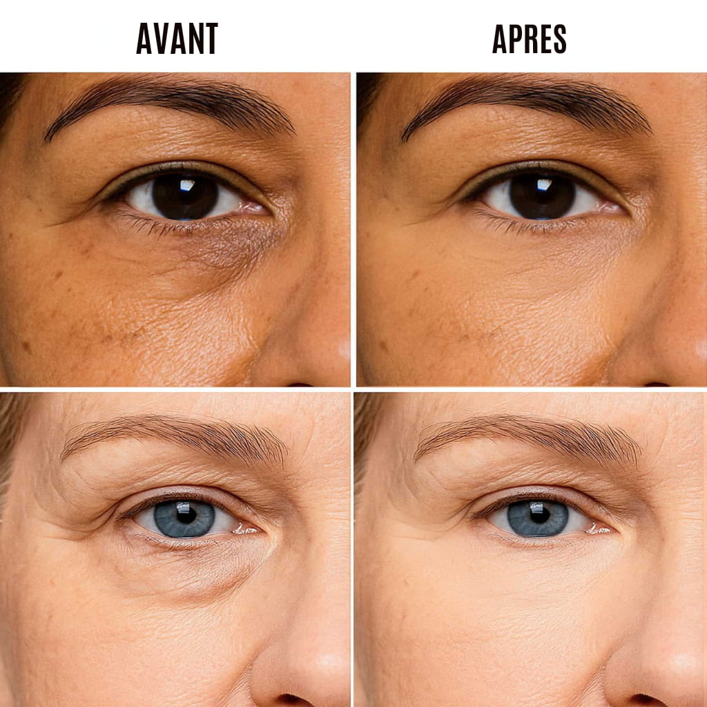 LUMIEYES - CONTOUR POUR LES YEUX