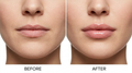 LipVéa — Sérum Repulpant Lèvres 5