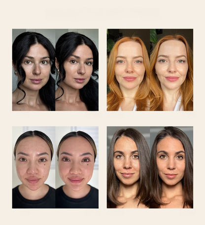 Avant / apres plusieurs femmes